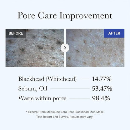 Medicube Zero Pore Blackhead Mud Mask 100g (Original)