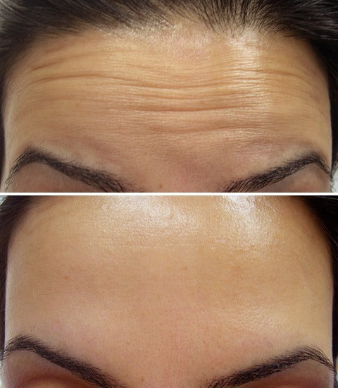 Celimax Vita-A Retinol Shot Skin Tightening Booster (Original)