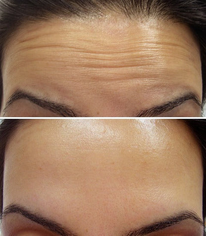 Celimax Vita-A Retinol Shot Skin Tightening Booster (Original)
