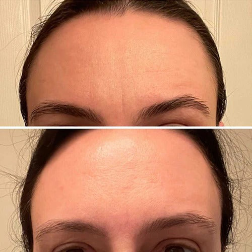 Celimax Vita-A Retinol Shot Skin Tightening Booster (Original)